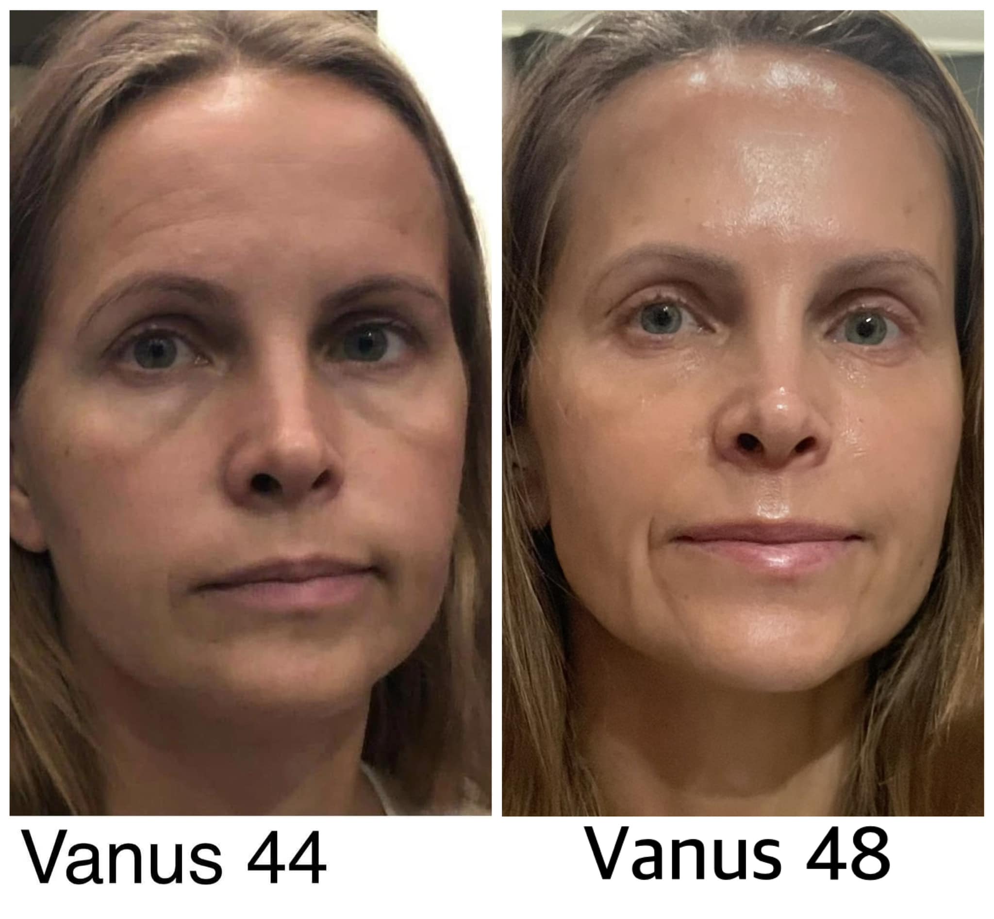 Näojooga_treener_Kaidi_Hunt