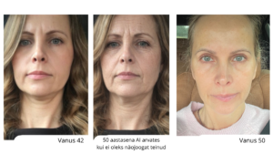 Teadlik Ilu Hunt Kaidiga, näojooga, energiameditsiin, noorendav toitumine