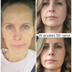 Teadlik Ilu Hunt Kaidiga, näojooga, energiameditsiin, noorendav toitumine