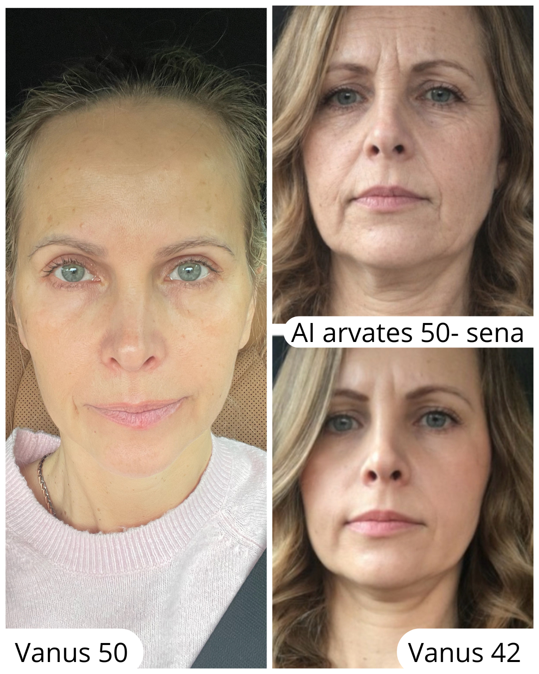 Teadlik Ilu Hunt Kaidiga, näojooga, energiameditsiin, noorendav toitumine